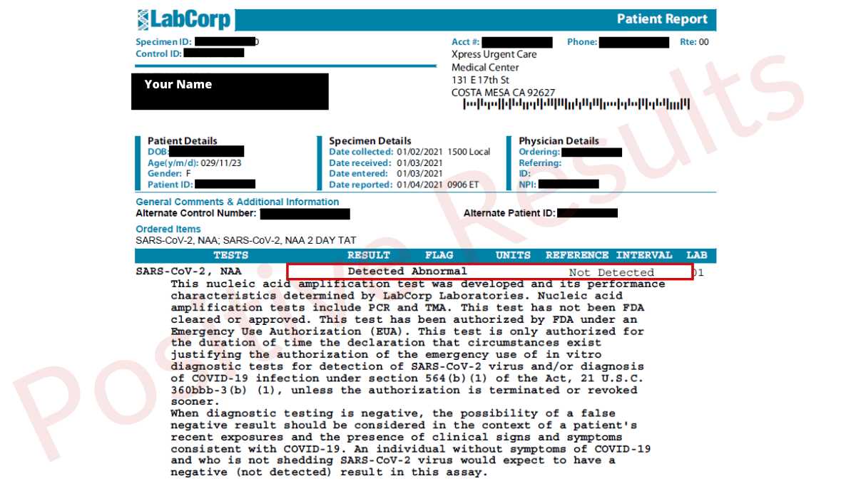 positive covid test results letter cvs template